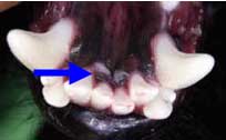 Soft tissue trauma of mandible from maloccluding maxillary incisors