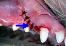Post extraction of primary canine tooth